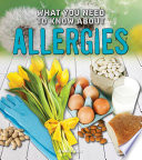 What You Need to Know About Allergies (Fact Finders: Focus on Health)
