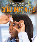What You Need to Know About Conjunctivitis (Fact Finders: Focus on Health)