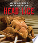 What You Need to Know About Head Lice (Fact Finders: Focus on Health)